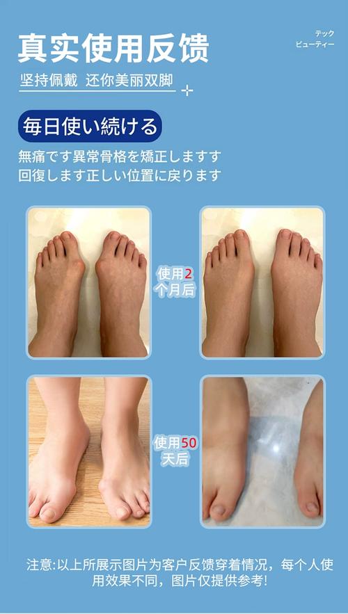 足部護理全攻略 給雙腳一場溫柔的SPA